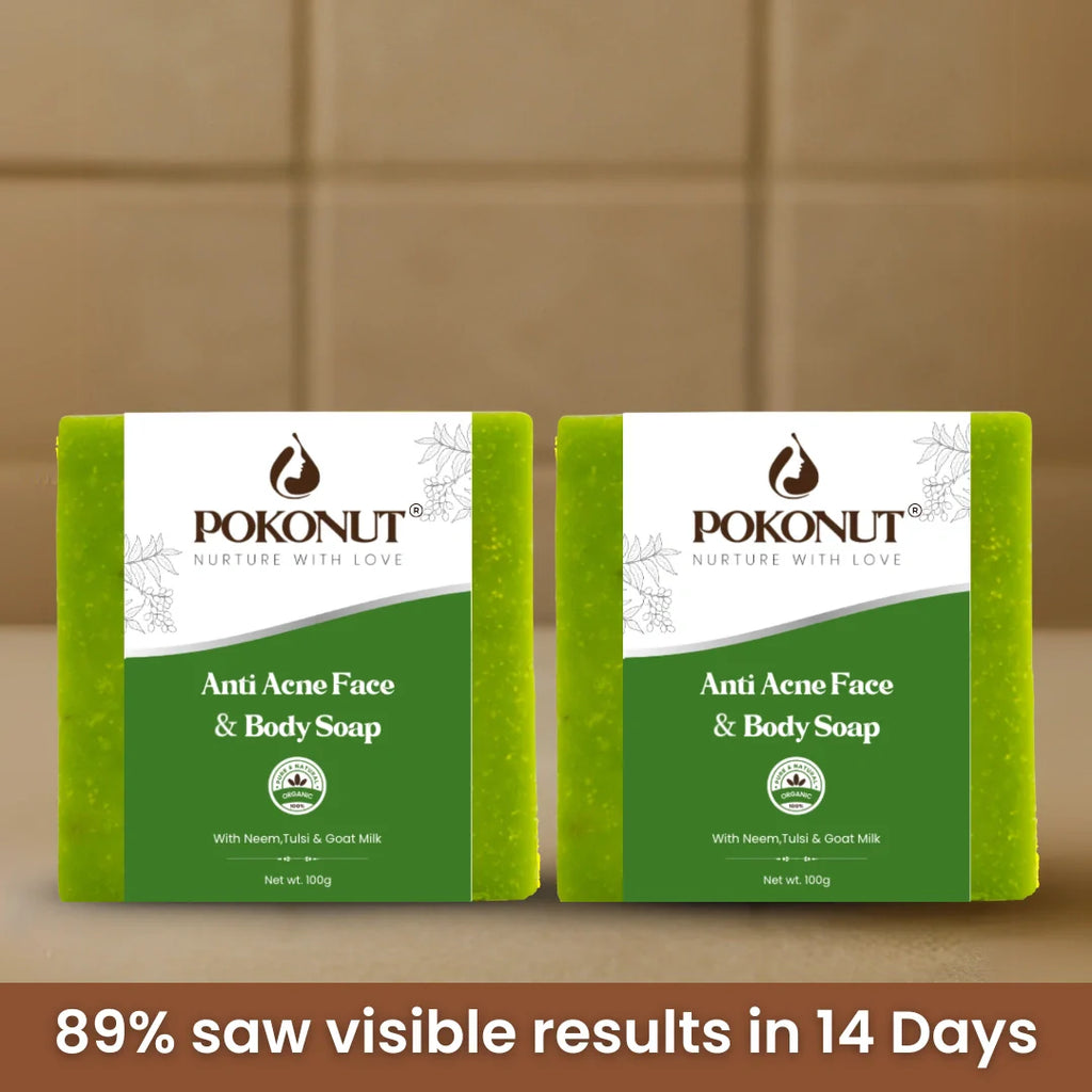 Anti acne soap -100g