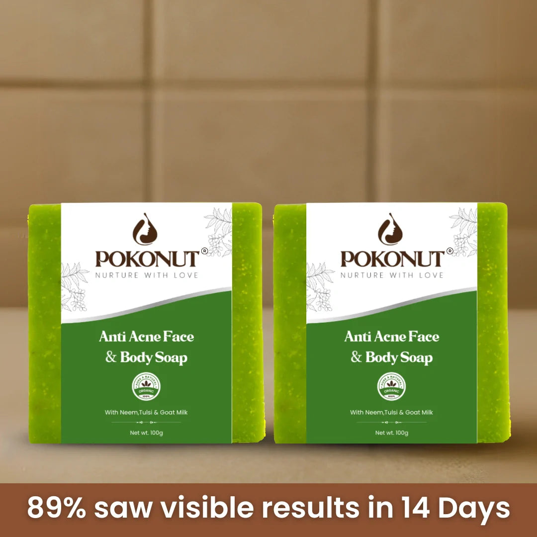 Anti acne soap -100g